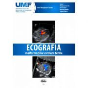 Ecografia Malformatiilor Cardiace Fetale. Brosura   DVD