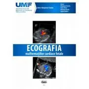 Ecografia Malformatiilor Cardiace Fetale. Brosura   DVD de Claudiu Marginean