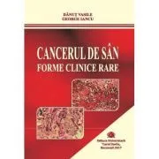 Cancerul de san. Forme clinice rare de Danut Vasile