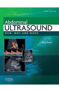 Abdominal Ultrasound