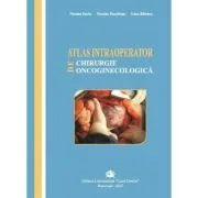Atlas intraoperator de chirurgie oncoginecologica de Irina Balescu
