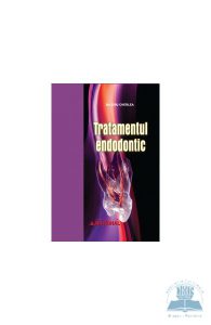Tratamentul Endodontic