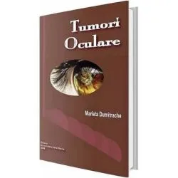 Tumori oculare de Marieta Dumitrache