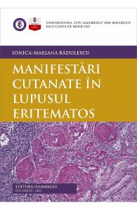Manifestari cutanate in lupusul eritematos