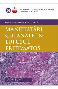 Manifestari cutanate in lupusul eritematos de Ionica-Mariana Radulescu
