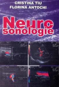 Neurosonologie de Cristina Tiu