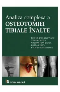 Analiza complexa a Osteotomiei Tibiale Inalte de Serban Dragosloveanu