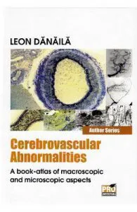 Cerebrovascular abnormalities de Leon Danaila