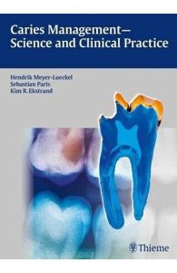 Caries Management