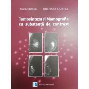 Tomosinteza si Mamografia cu substanta de contrast
