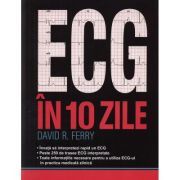 ECG-UL in 10 zile