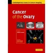 Cancer of the Ovary de Rodney Reznek