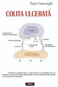 Colita ulcerata
