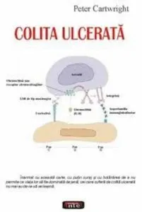 Colita ulcerata