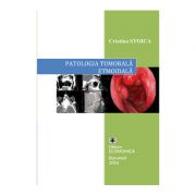 Patologia tumorala etmoidala. Strategii actuale in diagnostic si tratament