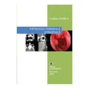 Patologia tumorala etmoidala. Strategii actuale in diagnostic si tratament de Cristina. Stoica