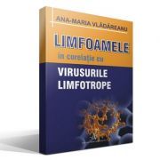 LIMFOAMELE SI VIRUSURILE LIMFOTROPE