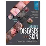 Andrews' Diseases of the Skin. Clinical Dermatology de William D. James