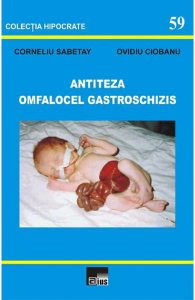 Antiteza omfalocel gastroschizis