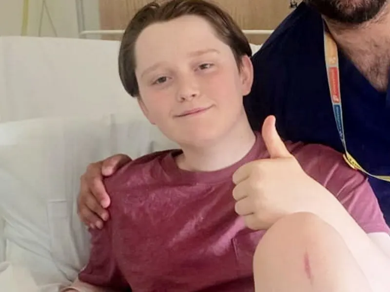 Boy, 14, loses chunk of leg after flesh-eating disease in Cheshire lake